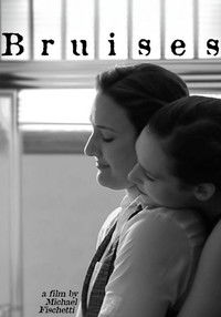 Bruises